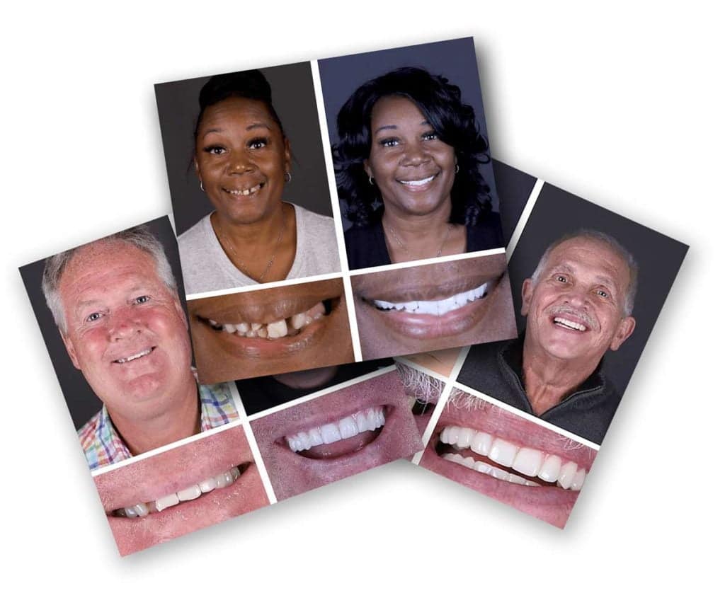 Jax-Implant-and-Denture-Gallery-section