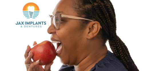 Permanent Fully Functional Full Mouth Implants in Jacksonville, Florida