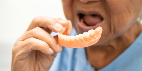 Dental Implants or Dentures: How to Choose The Right Replacement for You