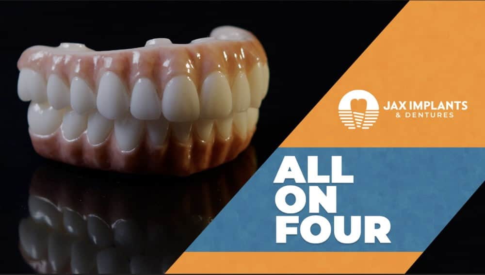 All on 4 dental implants video cover in Jacksonville, Florida