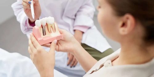 How to Choose the Right Type of Dental Implant for Your Needs 