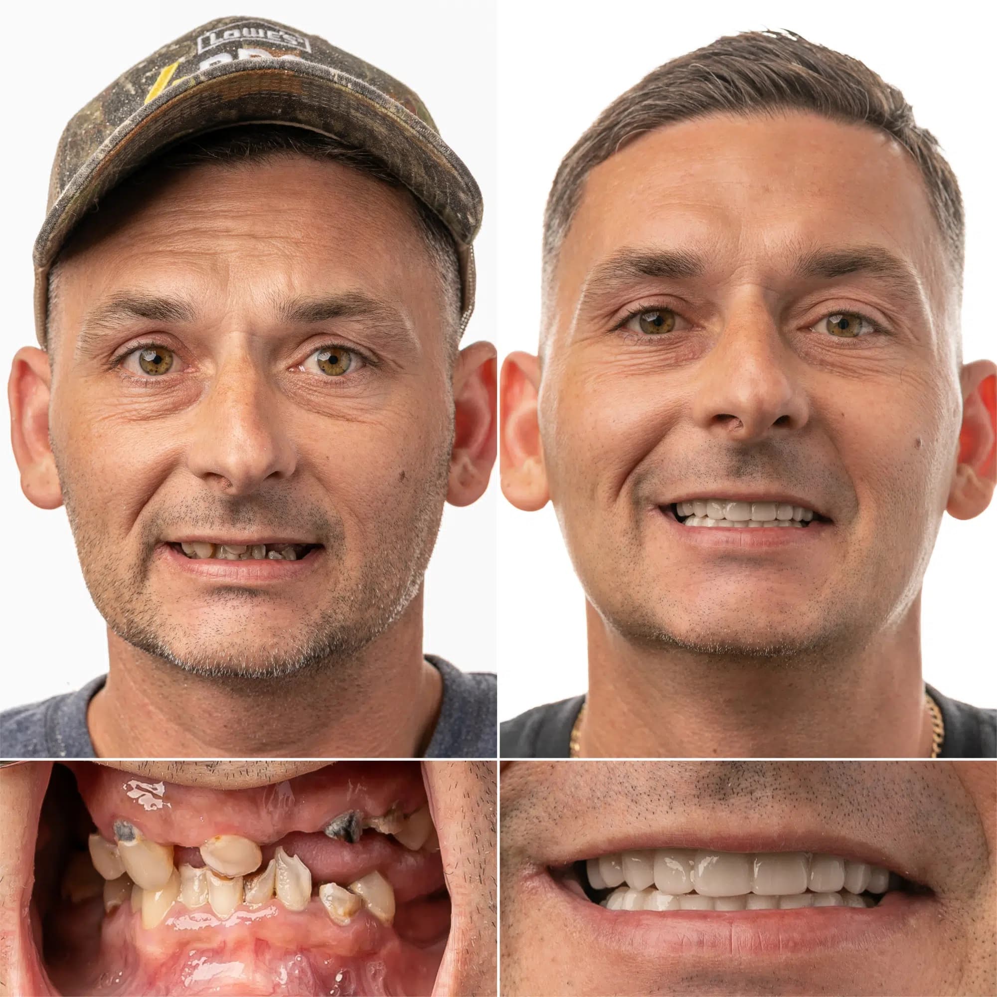 our happy customers in jax dental implant chris strickland