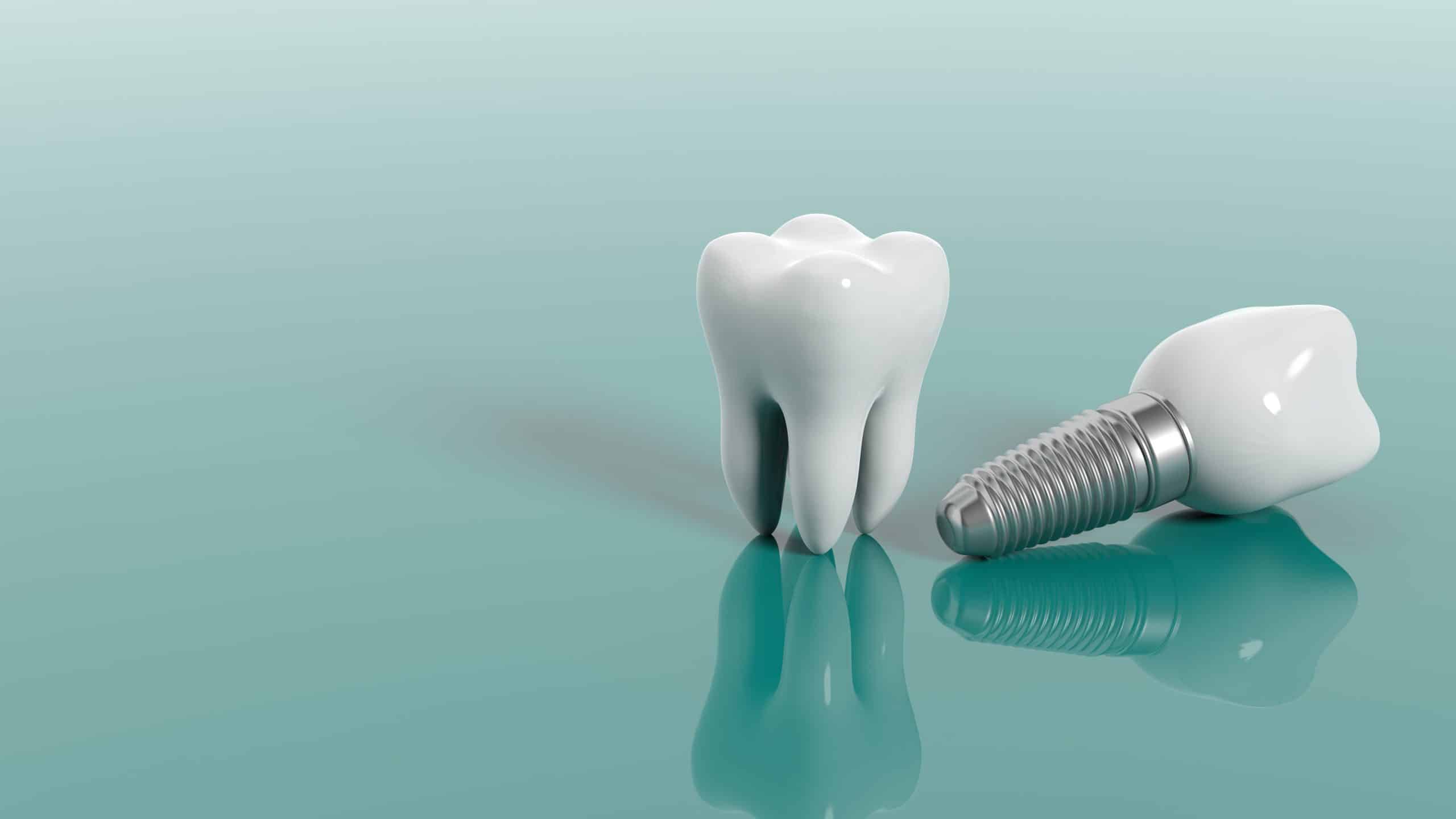 Read more about the article Frequently Asked Questions About Dentures and Implants: Answers from a Dental Expert