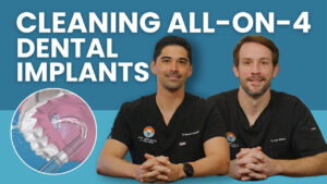 Cleaning All on 4 Dental Implants