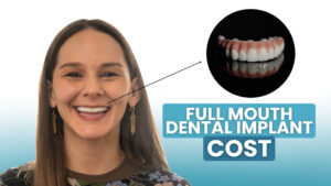 cost of dental implants in jacksonville